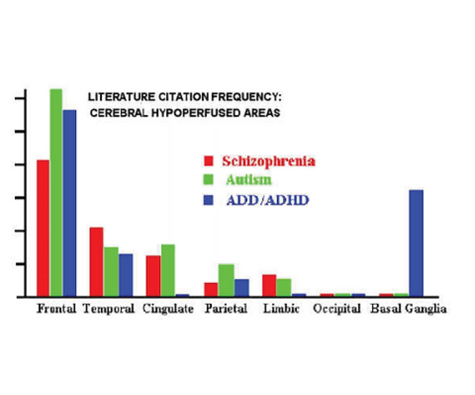 Cerebral Hypoperfusion